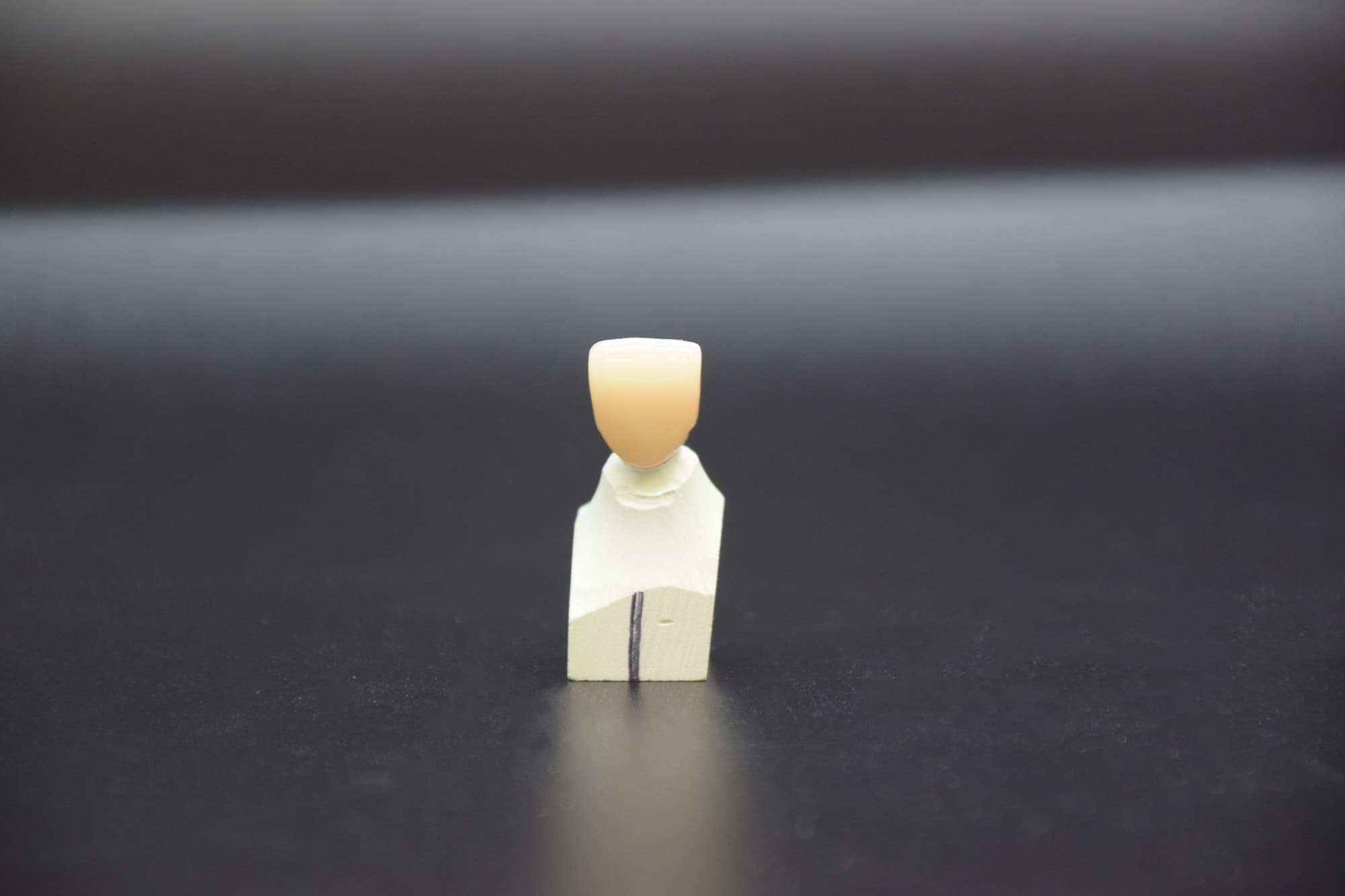 A single monolithic zirconia anterior crown seated on a working die, photographed against a dark background under directional light.