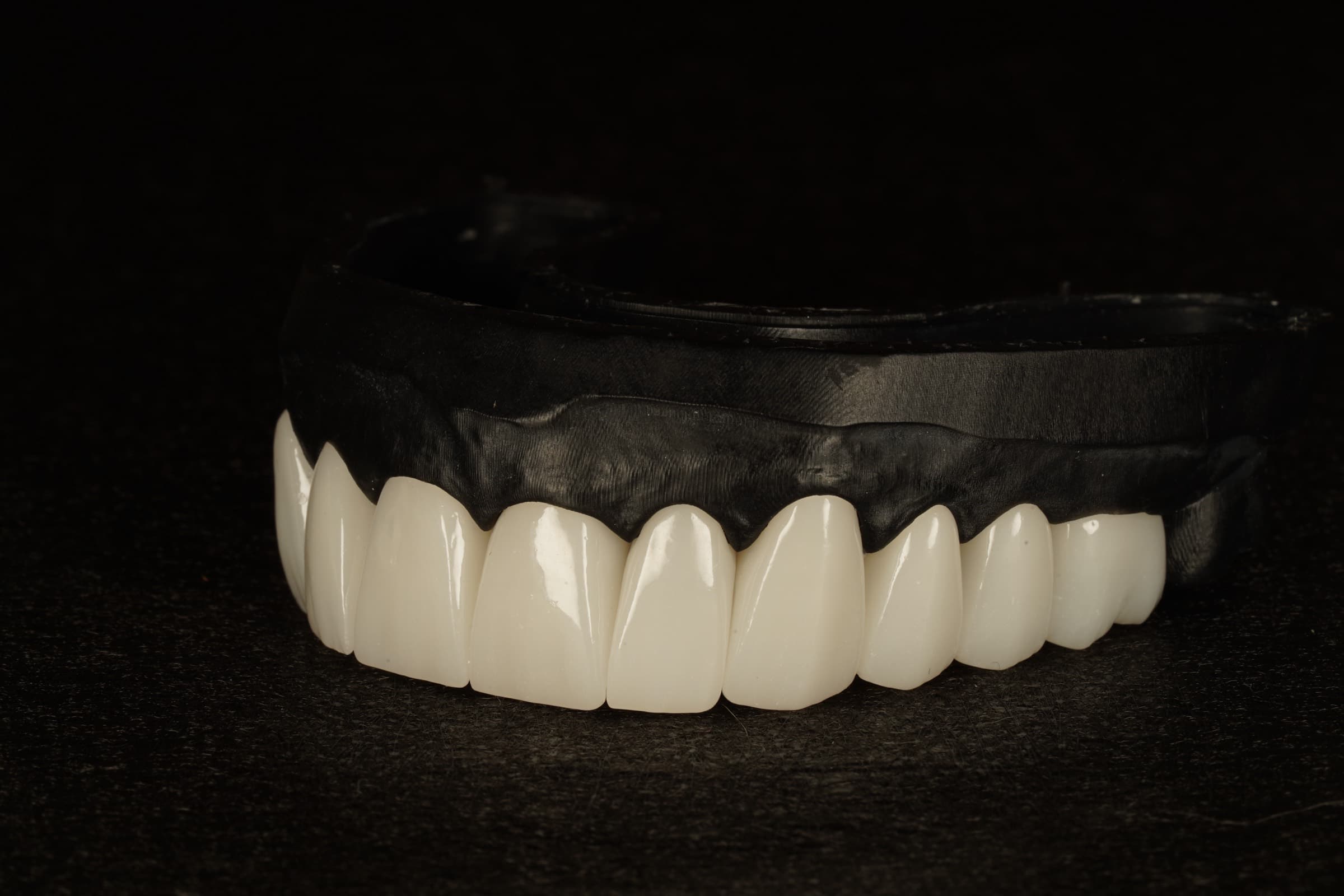 A full upper arch of layered ceramic restorations seen from the front on a dark working model.