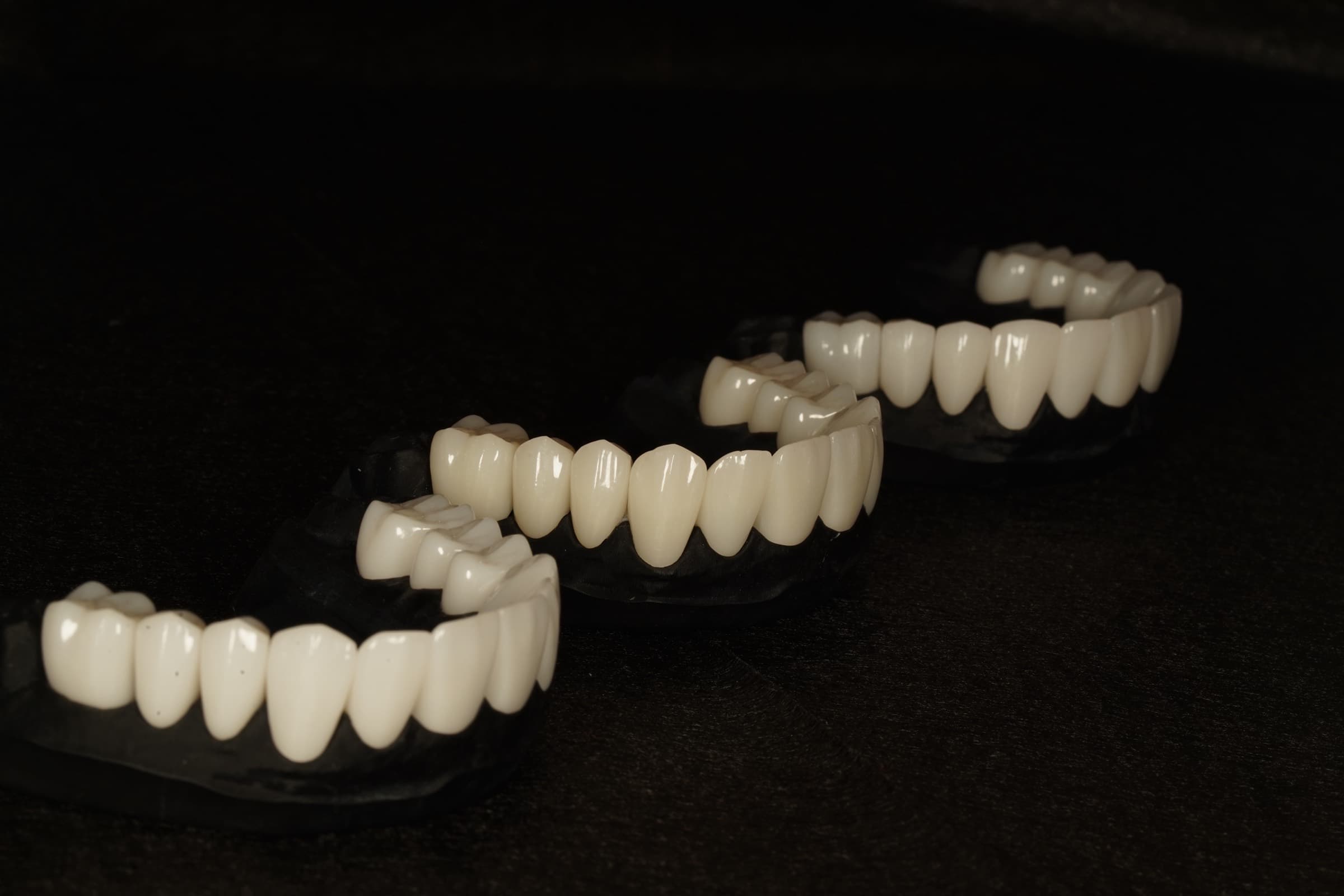 Two arches of finished ceramic restorations arranged on a dark bench surface.